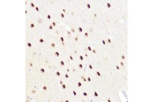 Immunohistochemistry of paraffin-embedded rat brain using CTIP2/BCL11B Rabbit pAb (ABIN7265808) at dilution of 1:50 (40x lens).