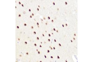 Immunohistochemistry of paraffin-embedded rat brain using CTIP2/BCL11B Rabbit pAb (ABIN7265808) at dilution of 1:50 (40x lens). (BCL11B anticorps)