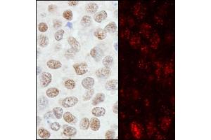 Immunohistochemistry (IHC) image for anti-Zinc Finger Protein 295 (ZNF295) (AA 875-925) antibody (ABIN7455231)