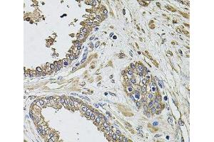 Immunohistochemistry of paraffin-embedded Human prostate using KCNK9 Polyclonal Antibody at dilution of 1:100 (40x lens). (KCNK9 anticorps)