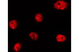 ABIN6266737 staining Hela by IF/ICC. (Histone H1 anticorps  (Internal Region))