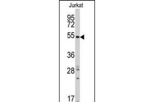 Western blot analysis of anti-RAI15 Antibody (C-term) ( (ABIN390172 and ABIN2840666) in Jurkat cell line lysates (35 μg/lane). (SMYD5 anticorps  (C-Term))