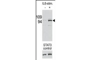 Image no. 1 for anti-Signal Transducer and Activator of Transcription 3 (Acute-Phase Response Factor) (STAT3) (pSer727) antibody (ABIN357083) (STAT3 anticorps  (pSer727))