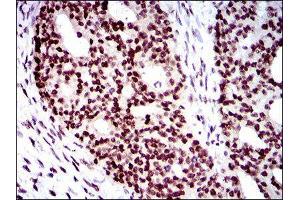 Immunohistochemistry (IHC) image for anti-Wolf-Hirschhorn Syndrome Candidate 2 (WHSC2) (AA 280-511) antibody (ABIN1846367)