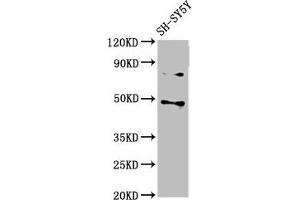 Western Blot Positive WB detected in: SH-SY5Y whole cell lysate All lanes: CSNK1E antibody at 3 μg/mL Secondary Goat polyclonal to rabbit IgG at 1/50000 dilution Predicted band size: 48 kDa Observed band size: 48 kDa (CK1 epsilon anticorps  (Isoform epsilon))