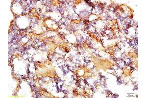 Formalin-fixed and paraffin embedded rat liver tissue with Anti-Collagen IV Polyclonal Antibody, Unconjugated  at 1:200, followed by conjugation to the secondary antibody and DAB staining