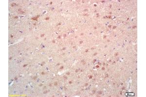 Formalin-fixed and paraffin embedded rat brain labeled with Rabbit Anti SAMD14 Polyclonal Antibody, Unconjugated (ABIN718346) at 1:200 followed by conjugation to the secondary antibody and DAB staining (SAMD14 anticorps  (AA 231-330))