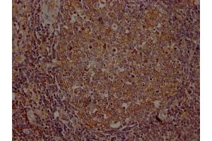 IHC image of ABIN7127585 diluted at 1:100 and staining in paraffin-embedded human lymph node tissue performed on a Leica BondTM system. (Recombinant ITK anticorps)