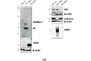 Comparative analysis of CPC-EVs and CPC-NVs characteristics and production process.