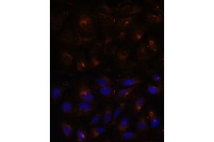 Immunofluorescence analysis of U-2 OS cells using ESYT1 antibody (ABIN7267069) at dilution of 1:100.