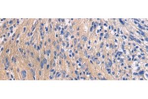 Immunohistochemistry of paraffin-embedded Human brain tissue using GALR3 Polyclonal Antibody at dilution of 1:50(x200) (GALR3 anticorps)