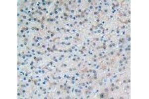 Detection of VCAM1 in Human Liver Tissue using Polyclonal Antibody to Vascular Cell Adhesion Molecule 1 (VCAM1)