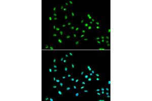 Immunofluorescence analysis of A549 cell using SMARCAD1 antibody. (SMARCAD1 anticorps)
