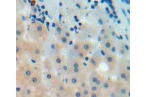 Used in DAB staining on fromalin fixed paraffin-embedded liver tissue (C9 anticorps  (AA 136-512))