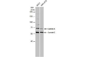 WB Image Various whole cell extracts (30 μg) were separated by 7. (Lamin A/C anticorps)