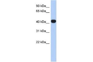 WB Suggested Anti-RASGEF1C Antibody Titration: 0. (RASGEF1C anticorps  (N-Term))