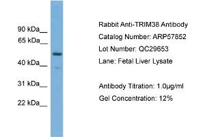 WB Suggested Anti-TRIM38  Antibody Titration: 0. (TRIM38 anticorps  (Middle Region))