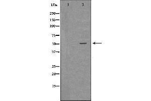 Western blot analysis of Hepg2 whole cell lysates, using CTSA Antibody. (CTSA anticorps  (C-Term))