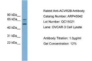 WB Suggested Anti-ACVR2B  Antibody Titration: 0.