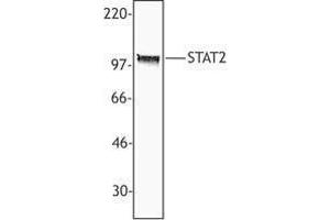 Western Blotting (WB) image for anti-Signal Transducer and Activator of Transcription 2, 113kDa (STAT2) antibody (ABIN2665501) (STAT2 anticorps)