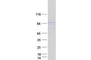 Validation with Western Blot