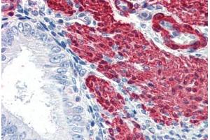 Human Uterus (formalin-fixed, paraffin-embedded) stained with TAGLN antibody ABIN337285 at 5 ug/ml followed by biotinylated anti-goat IgG secondary antibody ABIN481715, alkaline phosphatase-streptavidin and chromogen. (Transgelin anticorps  (AA 190-201))