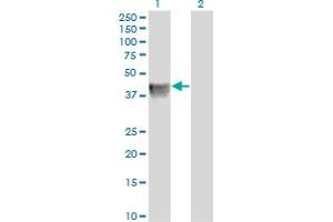 Western Blot analysis of BGN expression in transfected 293T cell line by BGN monoclonal antibody (M01), clone 4E1-1G7.