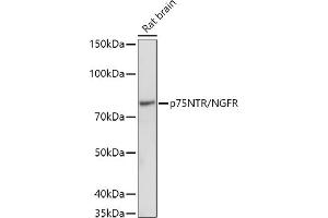 Western blot analysis of extracts of Rat brain, using (ABIN6127593, ABIN6144613, ABIN6144615 and ABIN6215090) at 1:1000 dilution. (NGFR anticorps  (AA 273-427))