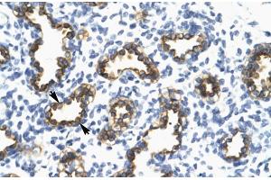 Human Lung; RFP2 antibody - middle region in Human Lung cells using Immunohistochemistry (TRIM13 anticorps  (Middle Region))