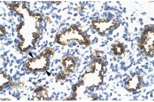 Human Lung; RFP2 antibody - middle region in Human Lung cells using Immunohistochemistry (TRIM13 anticorps  (Middle Region))