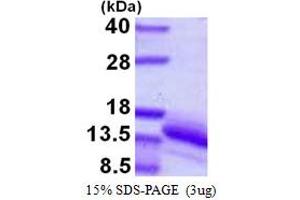 Vesicular, Overexpressed in Cancer, Prosurvival Protein 1 (VOPP1) (AA 82-172) protein (His tag)