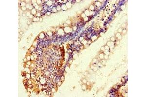 Immunohistochemistry of paraffin-embedded human small intestine tissue using ABIN7167648 at dilution of 1:100 (RTEL1 anticorps  (AA 975-1219))