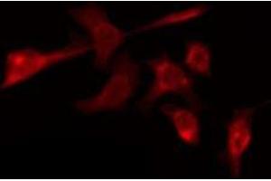 ABIN6276095 staining COLO205 by IF/ICC.