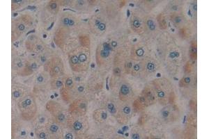 DAB staining on IHC-P; Samples: Human Liver Tissue
