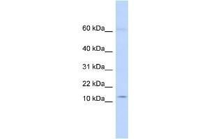 WB Suggested Anti-KRTAP8-1 Antibody Titration:  0. (KRTAP8-1 anticorps  (Middle Region))