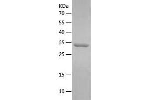 Western Blotting (WB) image for Insulin-Like Growth Factor 1 (IGF1) (AA 49-118) protein (His-IF2DI Tag) (ABIN7123449) (IGF1 Protein (AA 49-118) (His-IF2DI Tag))