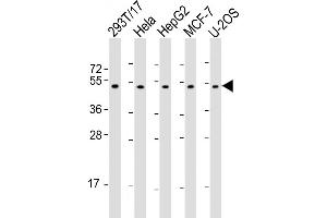 All lanes : Anti-PLAGL1 Antibody (N-Term) at 1:2000 dilution Lane 1: 293T/17 whole cell lysate Lane 2: Hela whole cell lysate Lane 3: HepG2 whole cell lysate Lane 4: MCF-7 whole cell lysate Lane 5: U-2OS whole cell lysate Lysates/proteins at 20 μg per lane. (PLAGL1 anticorps  (AA 112-146))