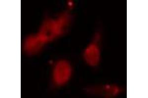 ABIN6273522 staining HeLa cells by IF/ICC. (PMS2 anticorps  (C-Term))
