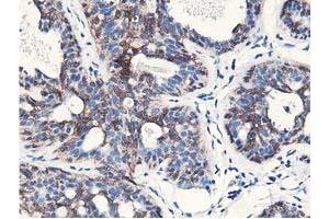 Immunohistochemical staining of paraffin-embedded Human breast tissue using anti-NUDT18 mouse monoclonal antibody. (NUDT18 anticorps)