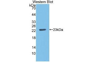 Figure. (CD40 anticorps  (AA 24-193))
