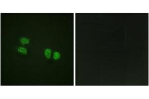 Immunofluorescence analysis of HeLa cells, using DDX5/DEAD-box Protein 5 (Phospho-Tyr593) Antibody.