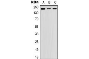 Western blot analysis of Laminin beta 1 expression in A431 (A), SW480 (B), PC3 (C) whole cell lysates. (Laminin beta 1 anticorps  (C-Term))