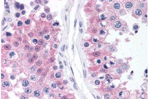 Human Testis (formalin-fixed, paraffin-embedded) stained with MAPK1 antibody ABIN218336 at 1:50 followed by biotinylated goat anti-rabbit IgG secondary antibody ABIN481713, alkaline phosphatase-streptavidin and chromogen. (ERK2 anticorps  (C-Term))