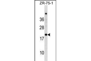 CDKN2A Antibody (N-term S8) (ABIN6243104 and ABIN6577380) western blot analysis in ZR-75-1 cell line lysates (35 μg/lane). (CDKN2A anticorps  (N-Term))