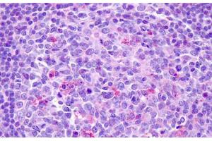 Anti-CCR7 antibody IHC staining of human tonsil.