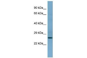 APIP antibody used at 1 ug/ml to detect target protein. (APIP anticorps  (Middle Region))