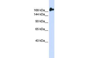 WB Suggested Anti-NUP98 Antibody Titration:  0.