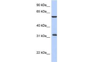 WB Suggested Anti-CDC34 Antibody Titration:  0. (CDC34 anticorps  (Middle Region))
