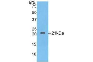 Western blot analysis of recombinant Rat IL17RE. (IL17RE anticorps  (AA 457-626))
