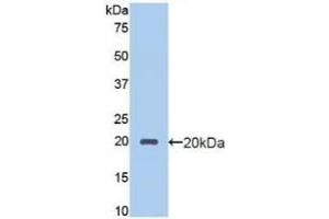 Detection of Recombinant PROCR, Human using Polyclonal Antibody to Endothelial protein C receptor (EPCR) (PROCR anticorps  (AA 63-205))